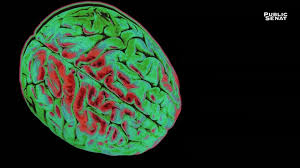 Documentaire – Le pouvoir nuit-il gravement au cerveau ?